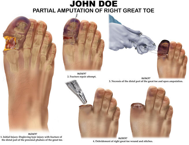 Procreate & Illustrator, 2023