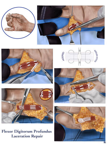 Procreate & Illustrator, 2023